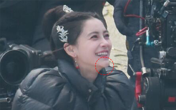 Angelababy lộ biến chứng phẫu thuật thẩm mỹ sau những tranh cãi với Huỳnh Hiểu Minh? Ảnh 2