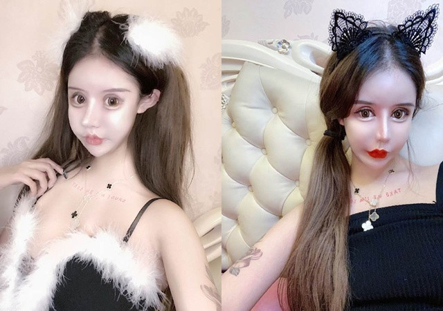 'Hotgirl thẩm mỹ' trải lòng chuyện dao kéo hơn 100 lần của bản thân khiến nhiều người bàng hoàng Ảnh 10