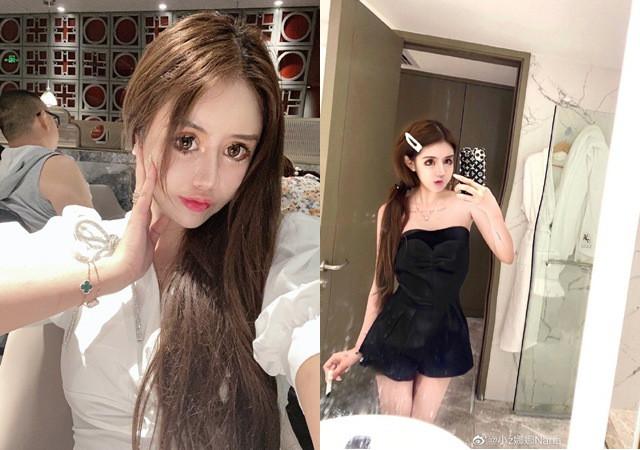 'Hotgirl thẩm mỹ' trải lòng chuyện dao kéo hơn 100 lần của bản thân khiến nhiều người bàng hoàng Ảnh 9