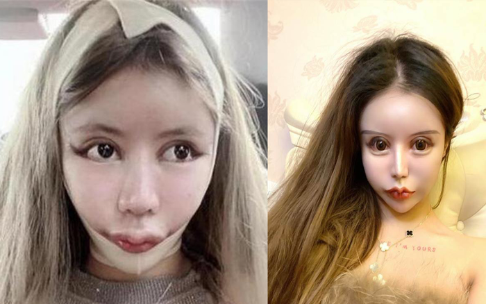 'Hotgirl thẩm mỹ' trải lòng chuyện dao kéo hơn 100 lần của bản thân khiến nhiều người bàng hoàng Ảnh 2