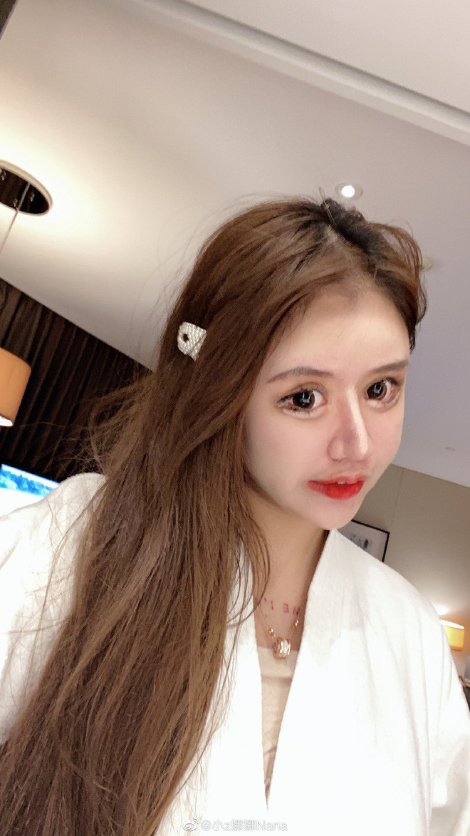 Diện mạo của Na Na bị cộng đồng mạng gán cho cái tên 'hotgirl mặt rắn'