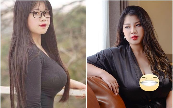 Cô gái Hải Dương phẫu thuật hút 6 lít mỡ nhưng vẫn không thể thu gọn cơ thể Ảnh 2