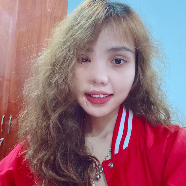 Bất ngờ nhan sắc hiện tại của cô gái Đà Nẵng từng bị chồng sắp cưới tạt axit Ảnh 6