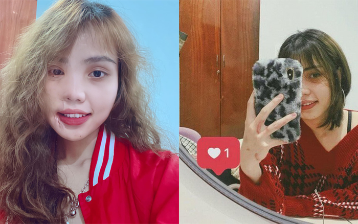 Bất ngờ nhan sắc hiện tại của cô gái Đà Nẵng từng bị chồng sắp cưới tạt axit Ảnh 2