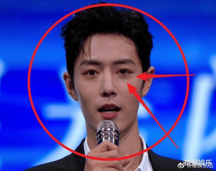 Tiêu Chiến gầy hốc hác, mắt thâm quần nhưng vẫn đẹp như tạc tượng Ảnh 10