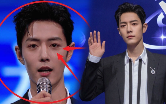 Tiêu Chiến gầy hốc hác, mắt thâm quần nhưng vẫn đẹp như tạc tượng Ảnh 2