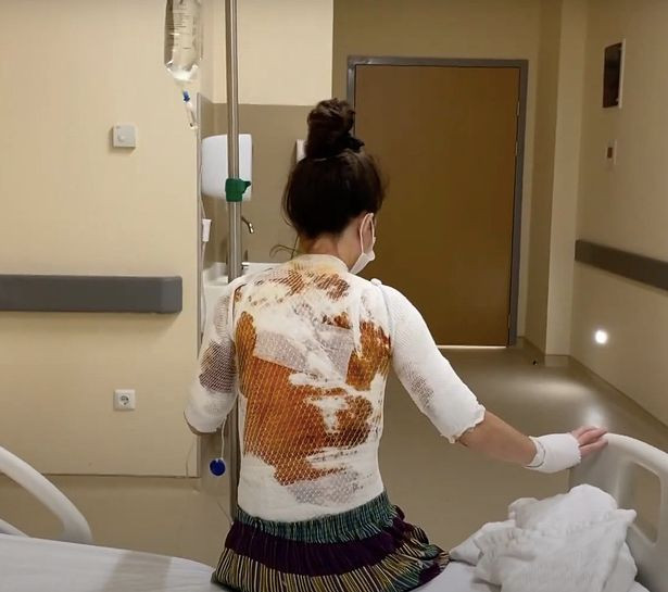 Người vợ đáng thương cho biết anh ta vốn định tạt nước vào mặt mình, nhưng cô đã kịp quay người né tránh. 