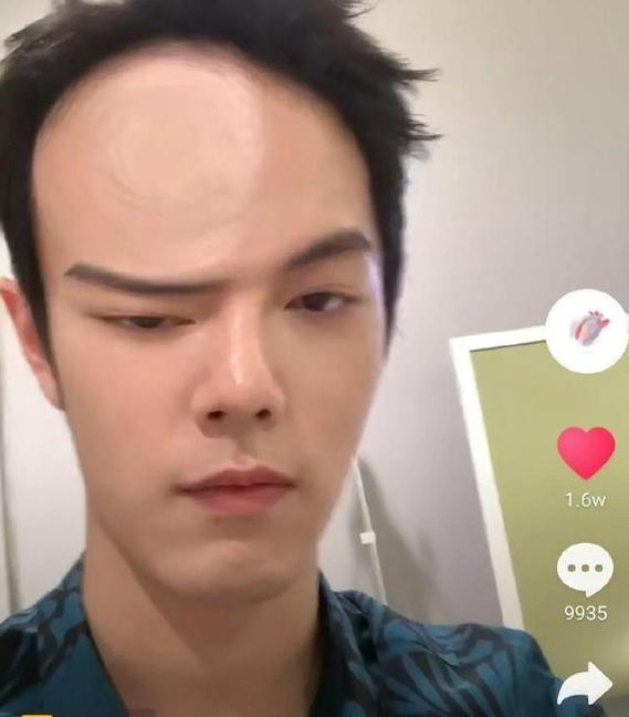 Nốt ruồi dưới môi Tiêu Chiến có ý nghĩa gì: Dù bị tẩy chay thì vẫn cứ hot! Ảnh 7