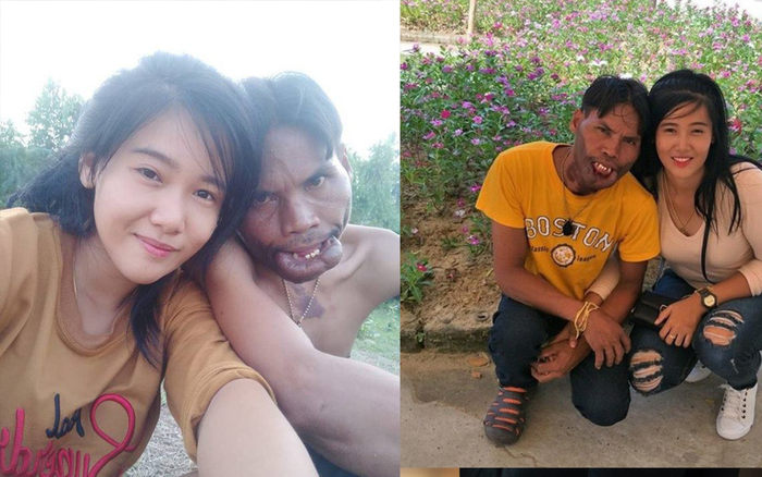 Cuộc hôn nhân không như mơ của chàng trai 'mặt quỷ' và 'vợ tiên' Ảnh 2