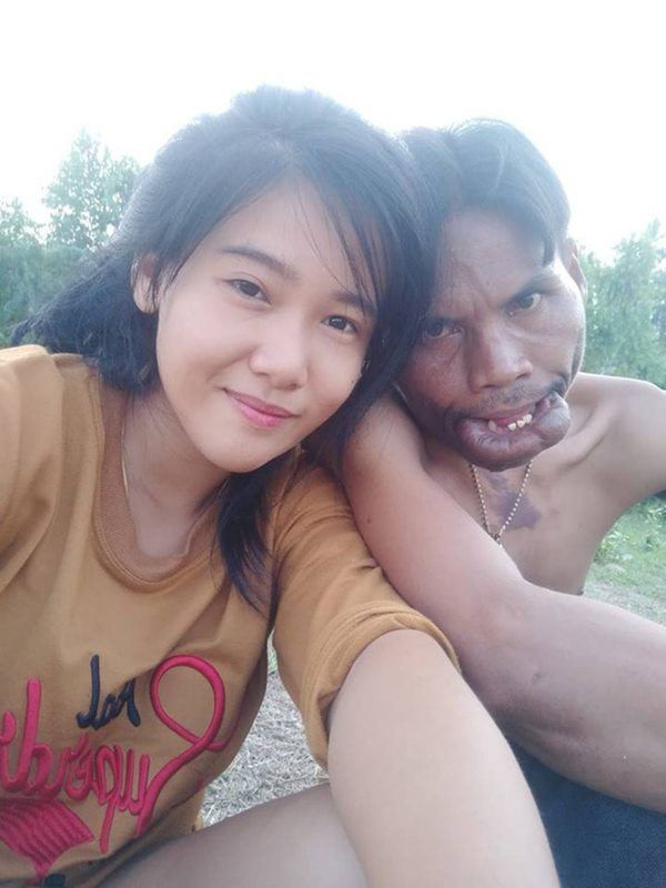 Cuộc hôn nhân không như mơ của chàng trai 'mặt quỷ' và 'vợ tiên' Ảnh 3