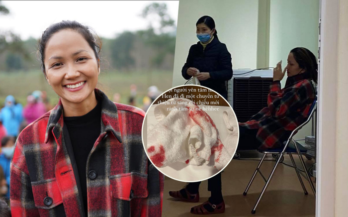 Hoa hậu H'Hen Niê gặp tai nạn ở mũi, 'đổ máu' tại khách sạn vì kiệt sức? Ảnh 2