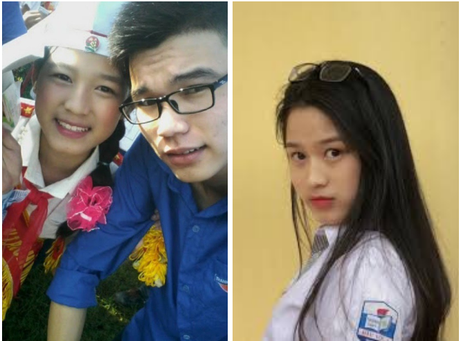 Được biết, khuyết điểm này đã theo Đỗ Thị Hà từ lâu, trong những hình ảnh thời còn học cấp 2 của cô đã có thể thấy rõ điều này