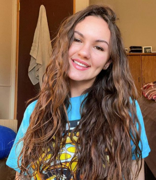 Cô gái 22 tuổi khoe gương mặt xinh đẹp với hàm răng giả.