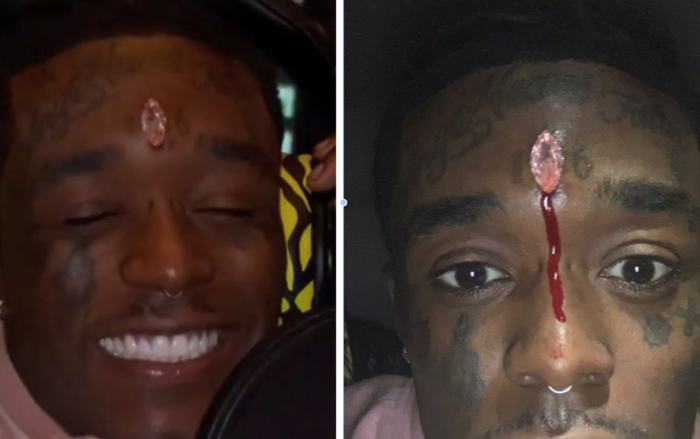 Nam rapper 'chơi trội' với kim cương hồng 24 triệu USD cấy trên trán Ảnh 2