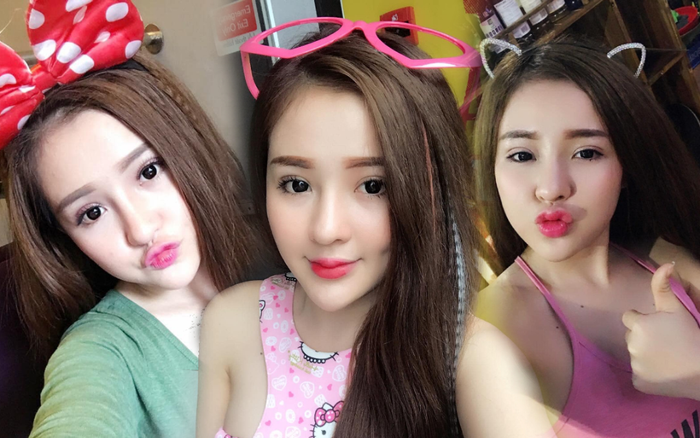 Ngân 98 hiếm hoi chia sẻ loạt ảnh thời tiêm đầy filler trên gương mặt Ảnh 2