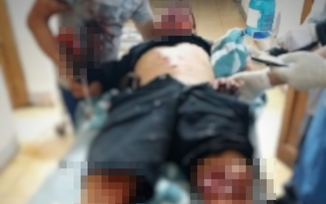 Hà Tĩnh: Nam thanh niên bị mất bàn tay sau vụ nổ lớn Ảnh 2