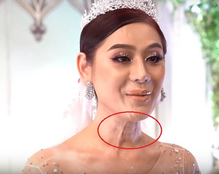 Khuôn mặt được trang điểm kỹ lưỡng thật chỉn chu nhưng làn da nhăn nheo ở cổ đã tố cáo tình trạng lão hóa da của Lâm Khánh Chi.