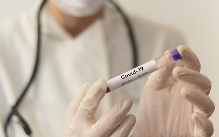 Người đàn ông tử vong khi đi du lịch Tam Đảo có kết quả âm tính với SARS-CoV-2 Ảnh 2