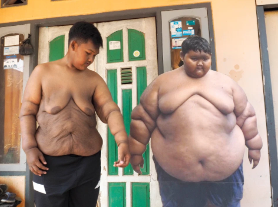 Trong vòng 3 năm ngắn ngủi, cân nặng của em chỉ còn lại 83 kg.