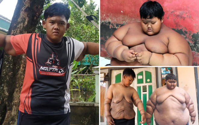 Hành trình 'lột xác' giảm 105 kg, trút bỏ da thừa của cậu bé béo nhất thế giới Ảnh 2