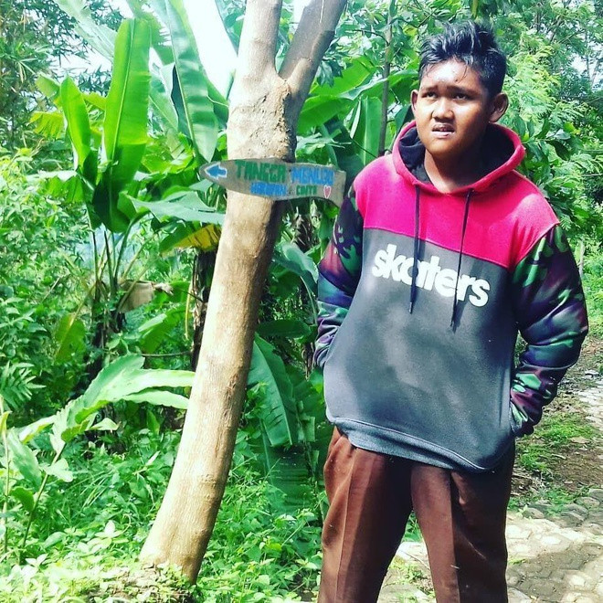 Ngoại hình thay đổi đáng kể của cậu bé béo nhất thế giới người Indonesia Ảnh 10