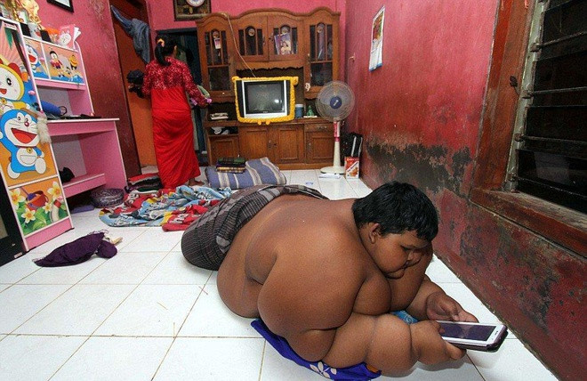 Ngoại hình thay đổi đáng kể của cậu bé béo nhất thế giới người Indonesia Ảnh 7