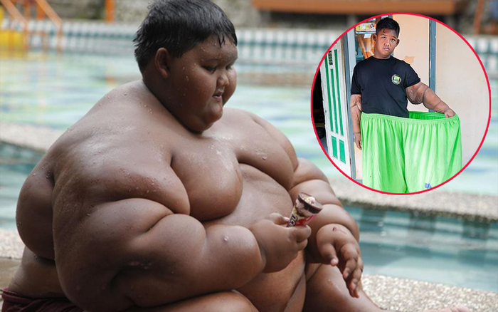 Ngoại hình thay đổi đáng kể của cậu bé béo nhất thế giới người Indonesia Ảnh 2