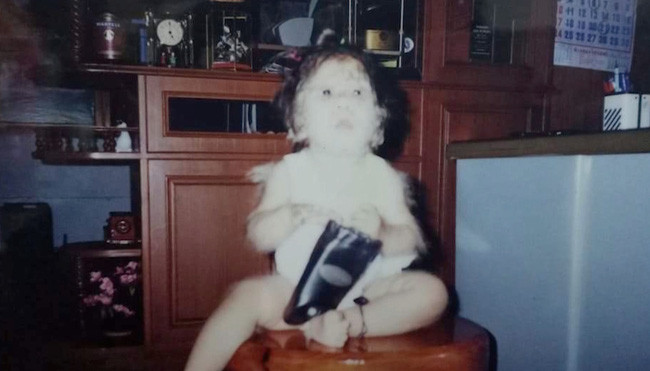 Hình ảnh lúc nhỏ của Supatra, cô đã mắc căn bệnh này từ khi sinh ra