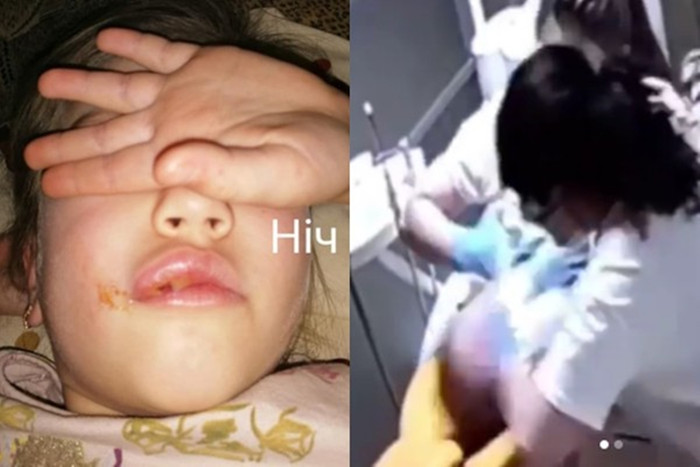 Bác sĩ và trợ lý của phòng khám nha khoa có hành vi bạo hành trẻ em.