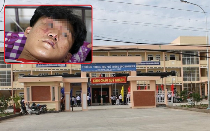 3 học sinh bị nhóm người lạ mặt xông vào trường lôi ra ngoài, đưa đến đường vắng rồi hành hung Ảnh 2