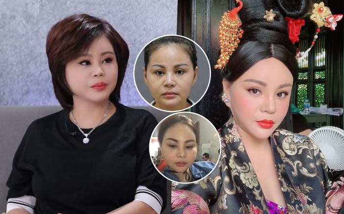 Lê Giang vui vẻ dù bị chê xấu: Phẫu thuật thẩm mỹ để mình hoàn hảo hơn, đẹp rồi thì chẳng cần phải sửa Ảnh 2