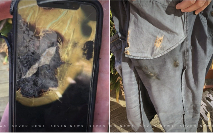 Khách hàng tố bị bỏng nặng do iPhone phát nổ, Apple thoái thác trách nhiệm đền bù Ảnh 2