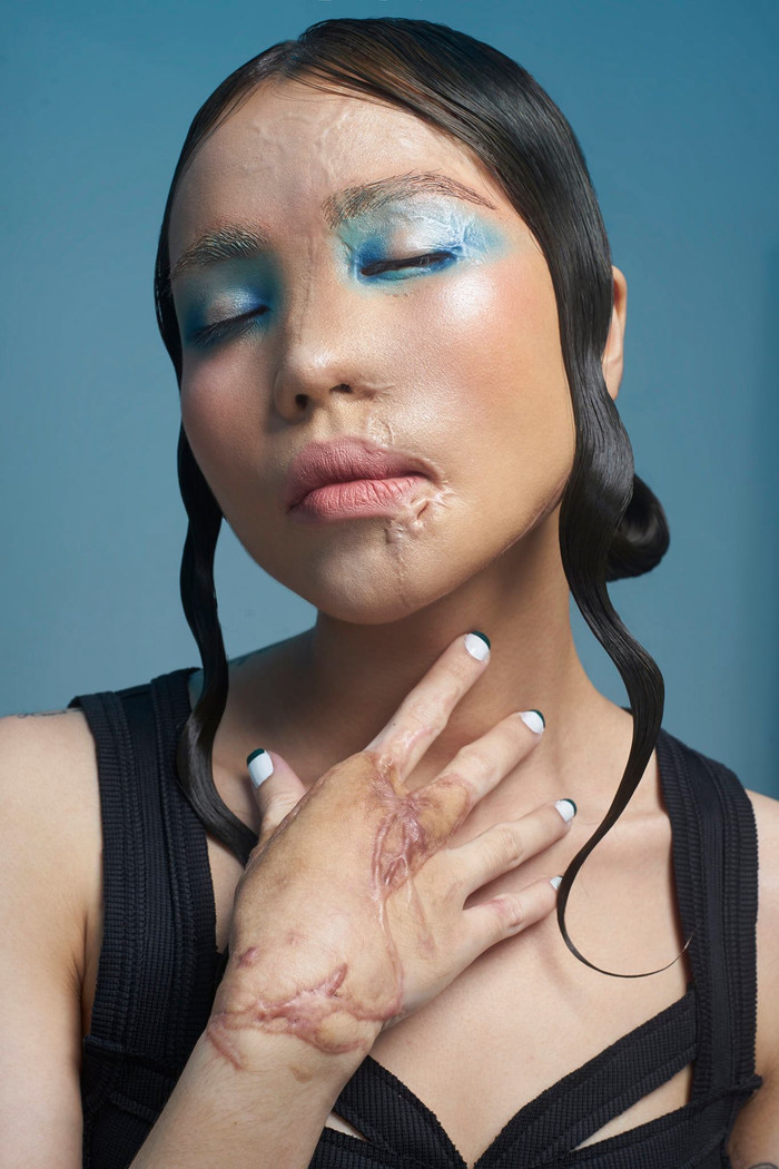 Cô gái bị chồng sắp cưới tạt axit khoe ngoại hình mới, thần thái tự tin không khác gì model Ảnh 4