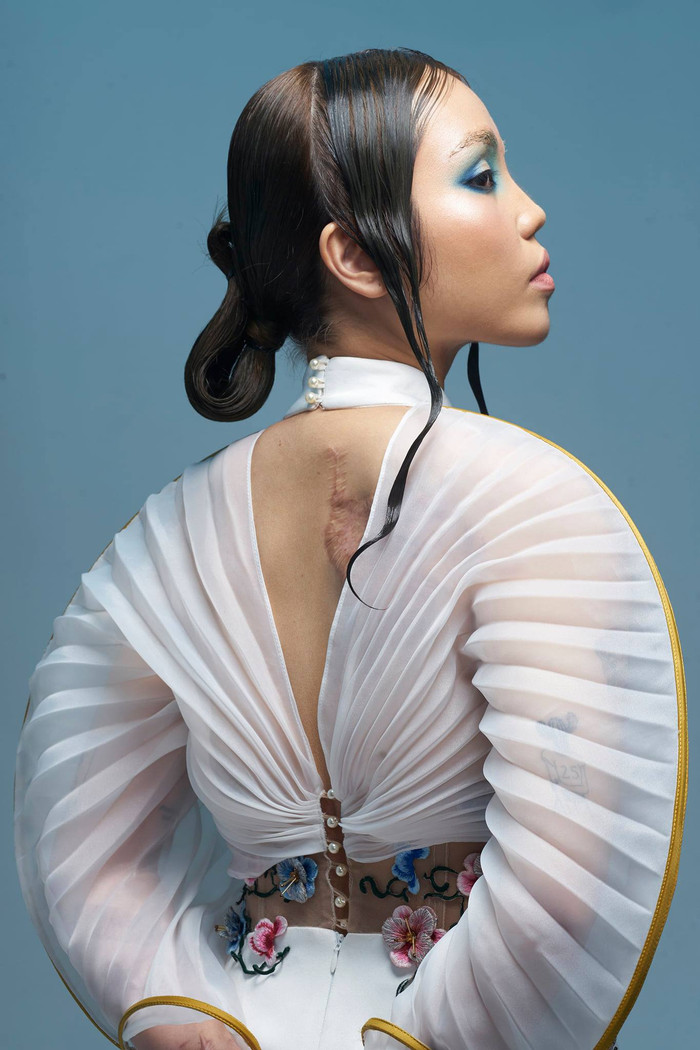 Cô gái bị chồng sắp cưới tạt axit khoe ngoại hình mới, thần thái tự tin không khác gì model Ảnh 10