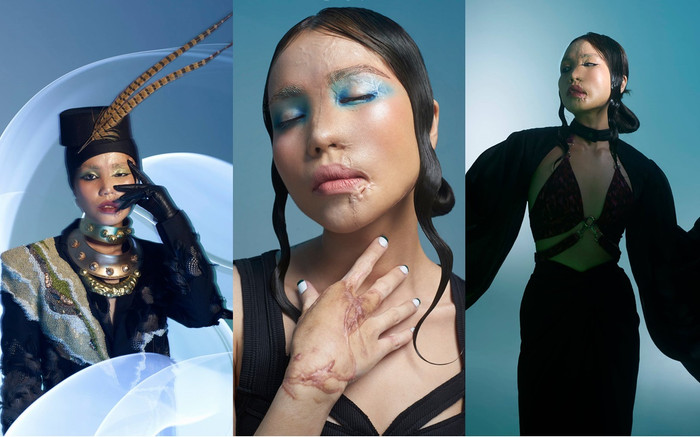 Cô gái bị chồng sắp cưới tạt axit khoe ngoại hình mới, thần thái tự tin không khác gì model Ảnh 2