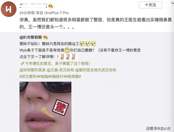 Một bác sỹ phẫu thuật thẩm mỹ nhận định Vương Nhất Bác đã đụng chạm dao kéo để thu nhỏ cánh mũi: 'Chỉ cần nhìn thoáng qua là giới chuyên môn cũng có thể nhận ra điều này'. Liệu rằng Vương Nhất Bác có khởi kiện người đăng bài viết này khi tung tin thất thiệt về anh hay không?