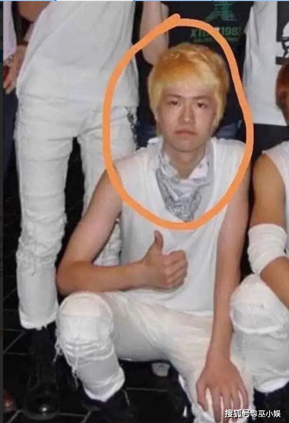 Ảnh quá khứ khi mới gia nhập giới giải trí của Vương Nhất Bác cho thấy mũi anh chàng khá là thô.