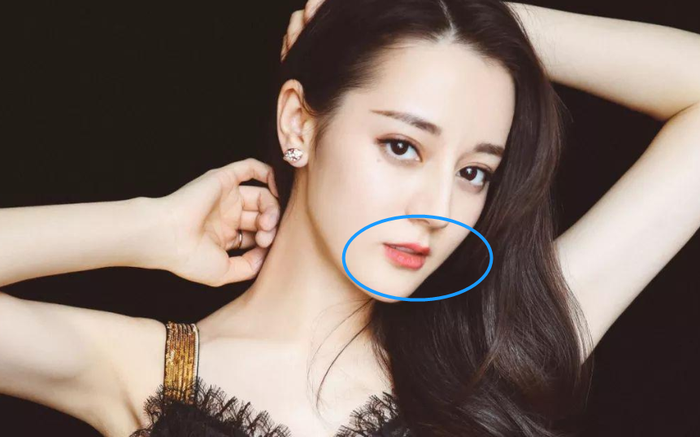 Trước đây, môi của Địch Lệ Nhiệt Ba khá mỏng