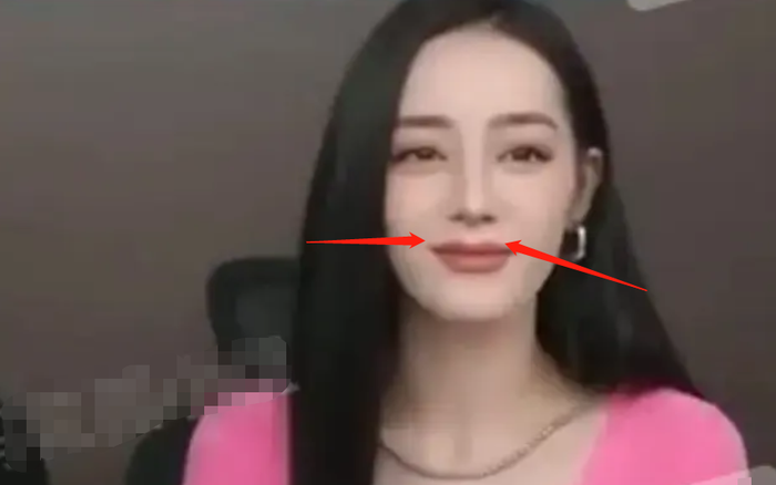 Cảm thấy mình vẫn chưa đủ đẹp, Địch Lệ Nhiệt Ba quyết định bơm môi? Ảnh 2