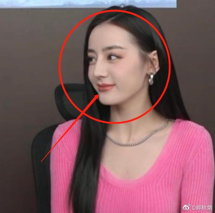 Địch Lệ Nhiệt Ba bơm môi cho giống Dương Mịch? Ảnh 8