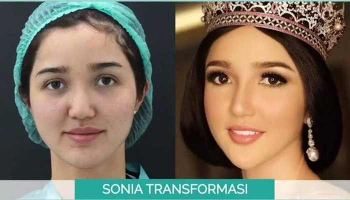 Sonia Fergina Citra - Đại diện Indonesia tại Miss Universe 2018.