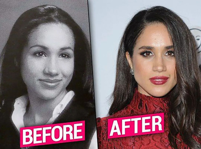 Meghan Markle lộ ảnh quá khứ khiến dân mạng đặt nghi vấn phẫu thuật thẩm mỹ vì chiếc mũi quá khác biệt Ảnh 6