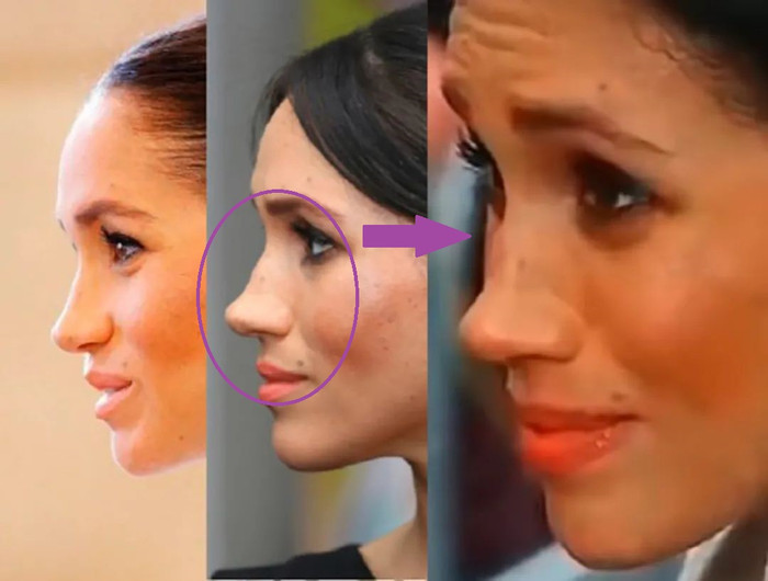 Meghan Markle lộ ảnh quá khứ khiến dân mạng đặt nghi vấn phẫu thuật thẩm mỹ vì chiếc mũi quá khác biệt Ảnh 8