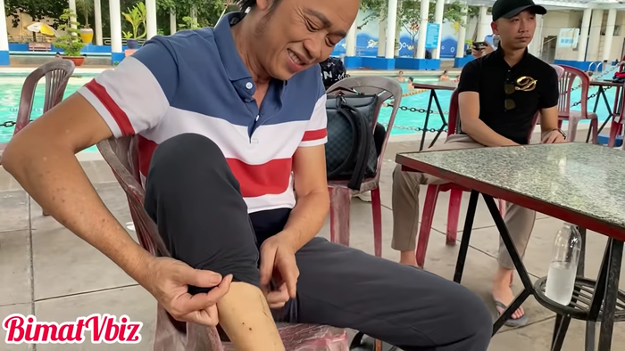 Vết sẹo dài ở ống đồng do bị cỏ cắt