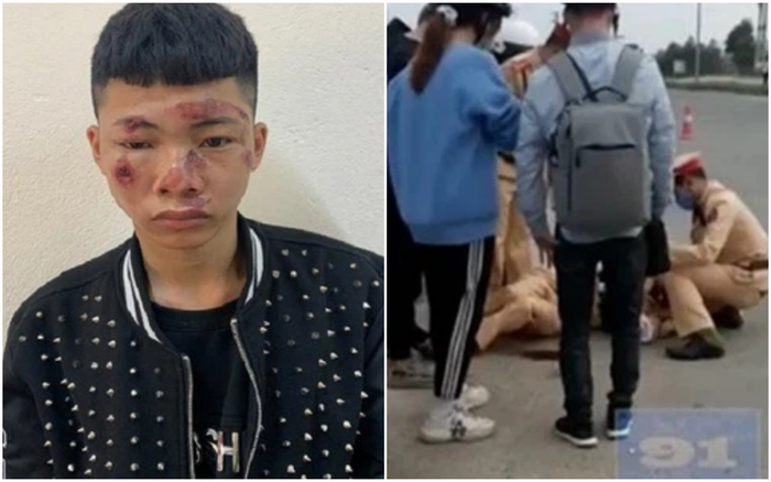 Vĩnh Phúc: Chiến sĩ CSGT bị 2 thiếu niên 17 tuổi vít ga xe máy tông gãy xương chân tay và xương gò má Ảnh 2