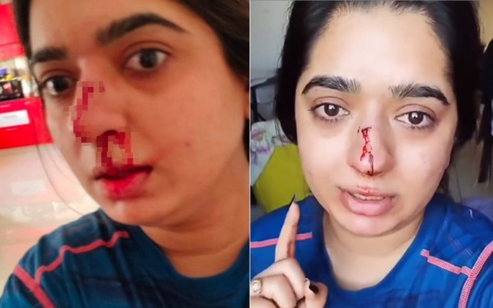 Shipper đánh nghệ sĩ trang điểm gãy xương mũi, sau đó còn tố ngược nạn nhân Ảnh 2