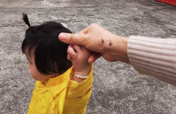 Chị Y. bị bó nhang đang cháy đụng trúng tay gây bỏng rát