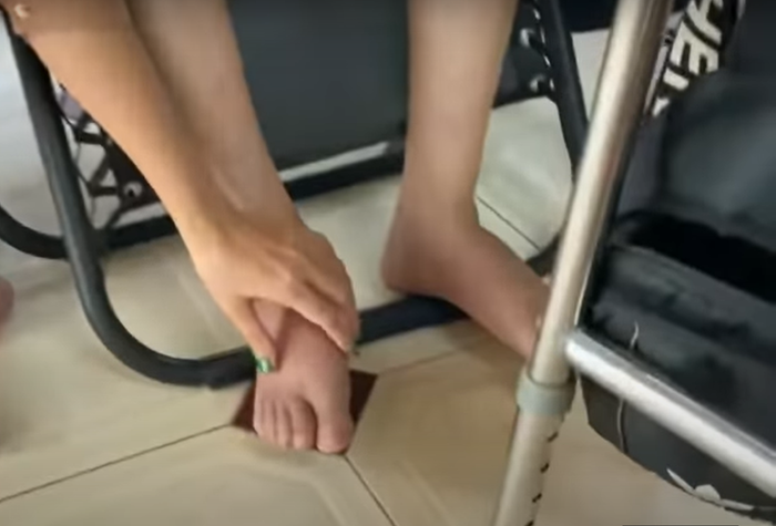 Chân của Mạc Can phù to khiến việc di chuyển khó khăn hơn. Ảnh chụp màn hình