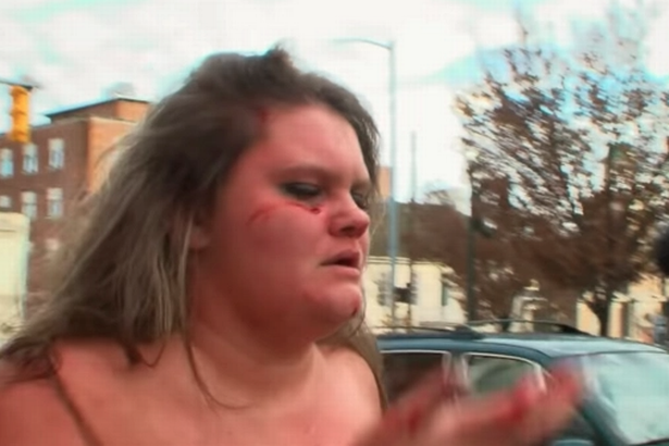 Mặt của Diamond đổ máu sau vụ xô xát.