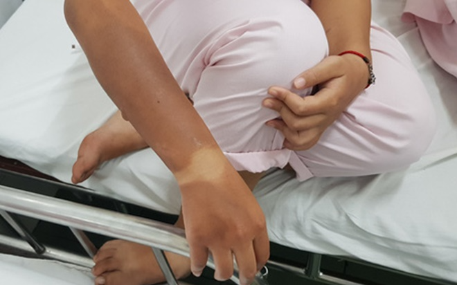 Bình gas mini phát nổ trong cuộc thi nấu ăn tại trường, 5 người nhập viện Ảnh 2